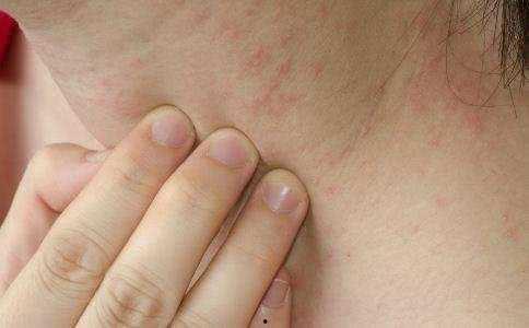 湿疹可以吃蛇瓜吗,蛇瓜的养生益处